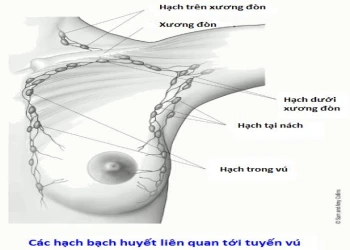 Ung thư vú là gì?