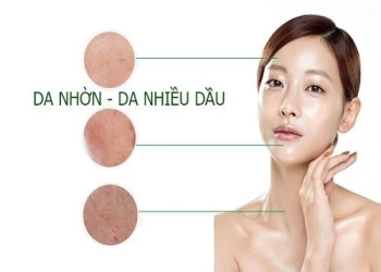 Cách làm mặt nạ cho da dầu bị nhờn bóng trong mùa hè