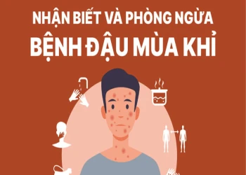 Cách phòng ngừa bệnh đậu mùa khỉ bạn nên biết