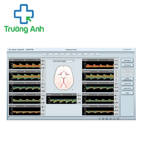 Máy siêu âm Doppler xuyên sọ Dolphin IQ của Viasonix