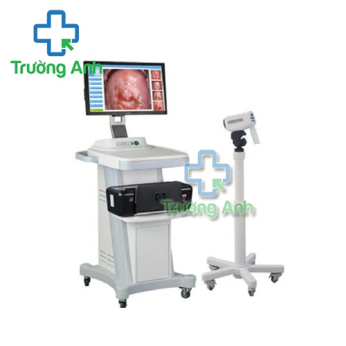 Máy soi CTC Video KTS GC-3000E - Máy soi cổ tử cung của GoldCare