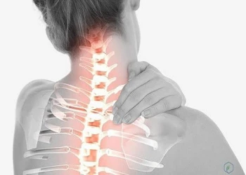 Thoái hóa đốt sống cổ là bệnh như thế nào?